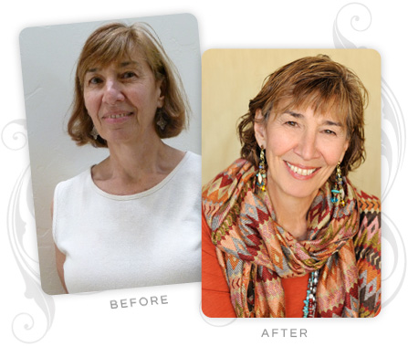 Marsha Lichtenstein Before and After